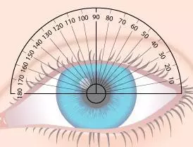 Mắt kính loạn thị